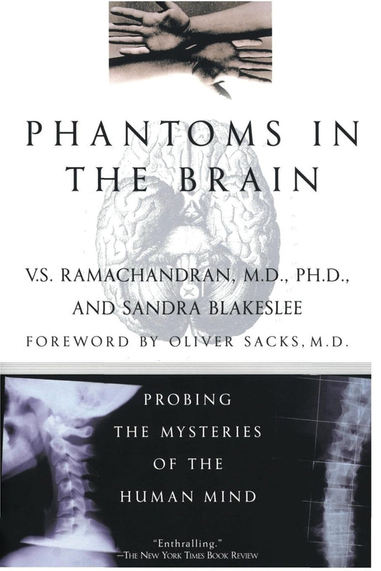 PHANTOMS IN THE BRAIN: PROBING T