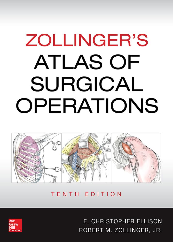 Zollinger's Atlas of Surgical Operations, Tenth Edition - 5851